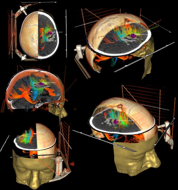 Image from Andras Jakab 2nd place winner of Visualization Contest at MICCAI 2009.