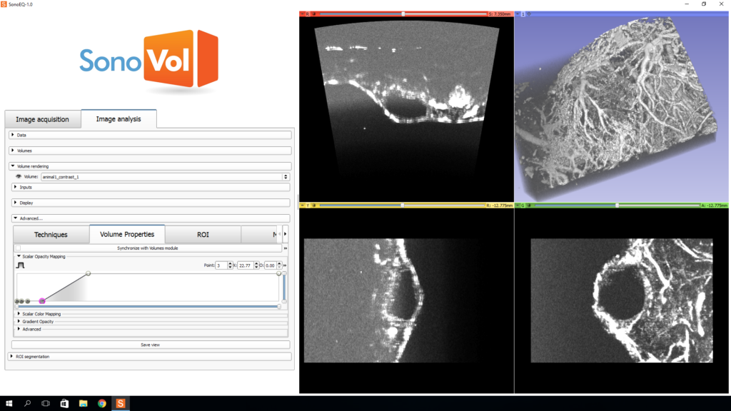 SonoVol application visualizing blood vessel reconstructed from multiple ultrasound sweeps.