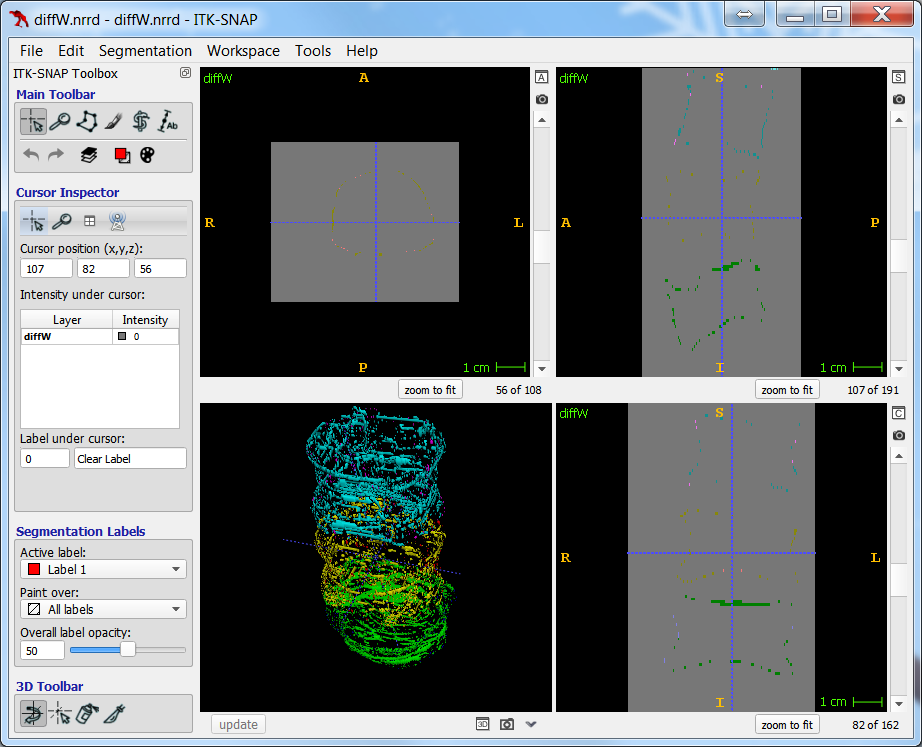 ITK-SNAP exhibits interpolation errors.