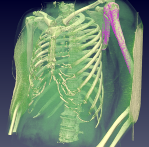 humerus-scapula_2_selection_cut