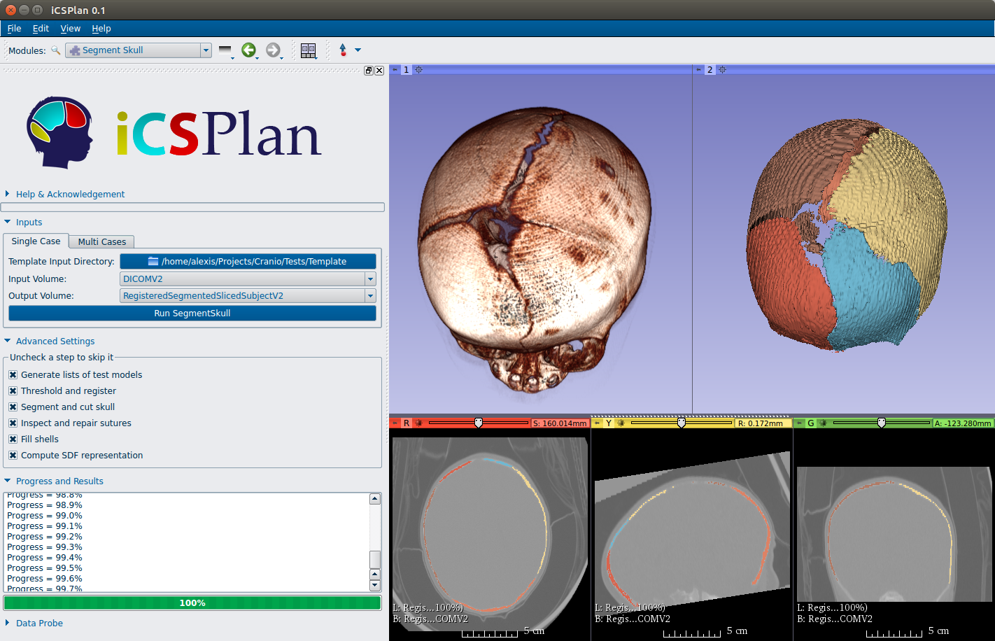 The graphical user interface of iCSPlan delivers real-time mesh modification, surface-based rendering, and volume visualization capabilities.