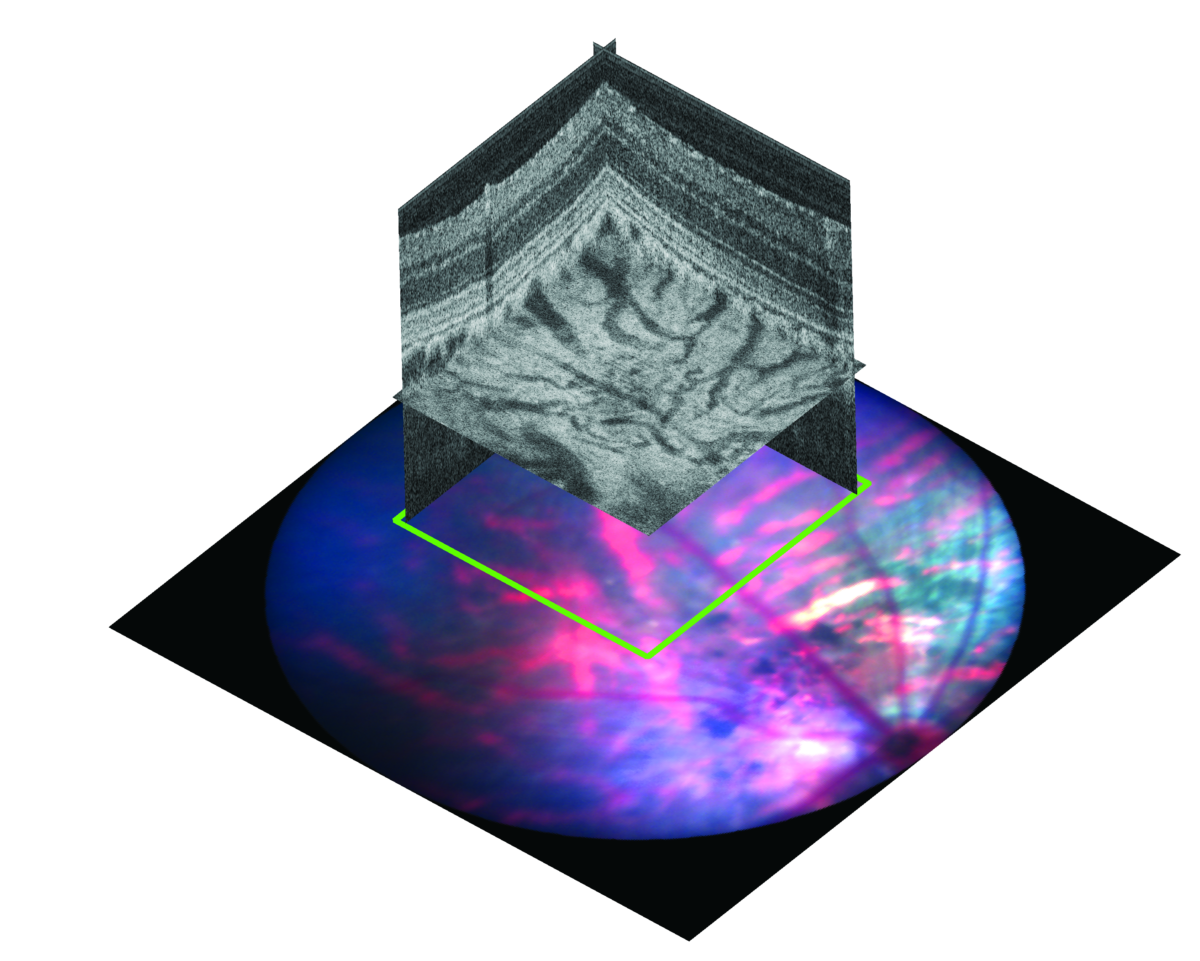 Kitware customer highlight Phoenix Research Labs