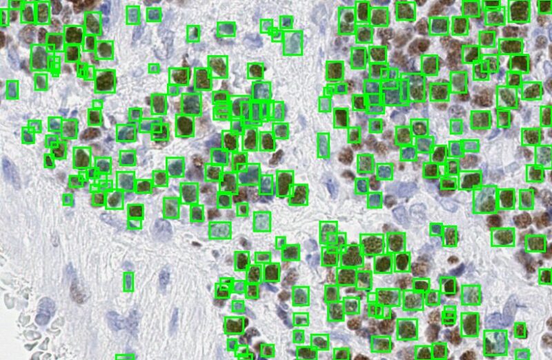 Cell Nuclei Detection on Whole-Slide Histopathology Images Using ...