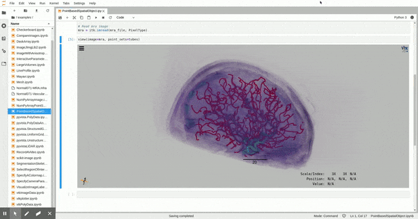 TubeTK brain vessels in itkwidgets