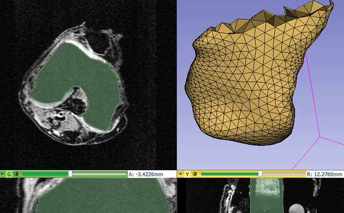 基于3D切片器的应用程序