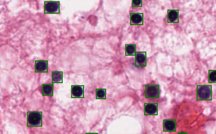 Bioinfomatics and Large Scale Imagery