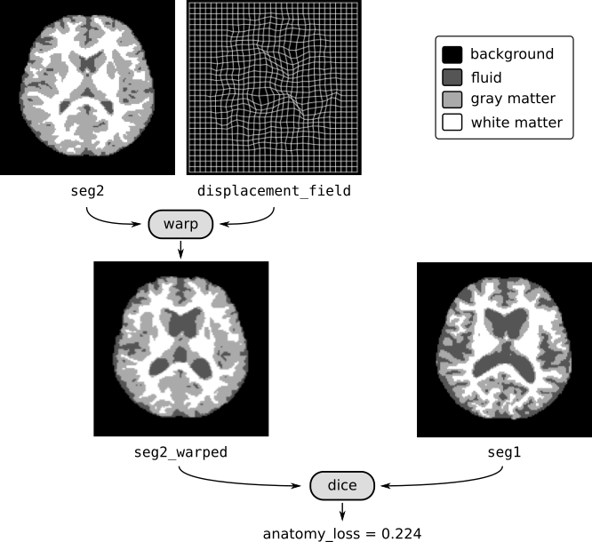anatomy loss brain MRI example