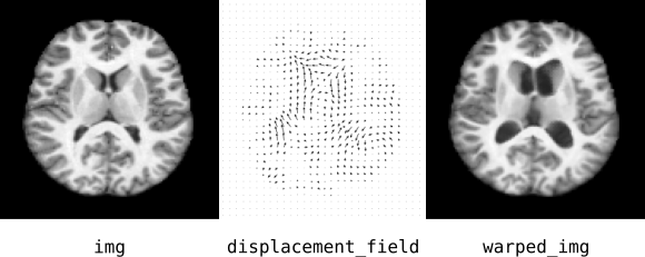 warping MRI example