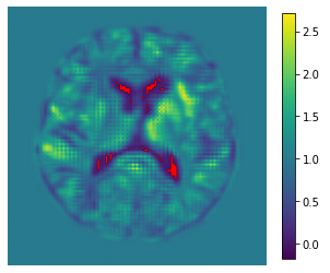 Jacobian determinant colormap example