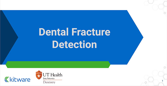 Dental Fracture Detection