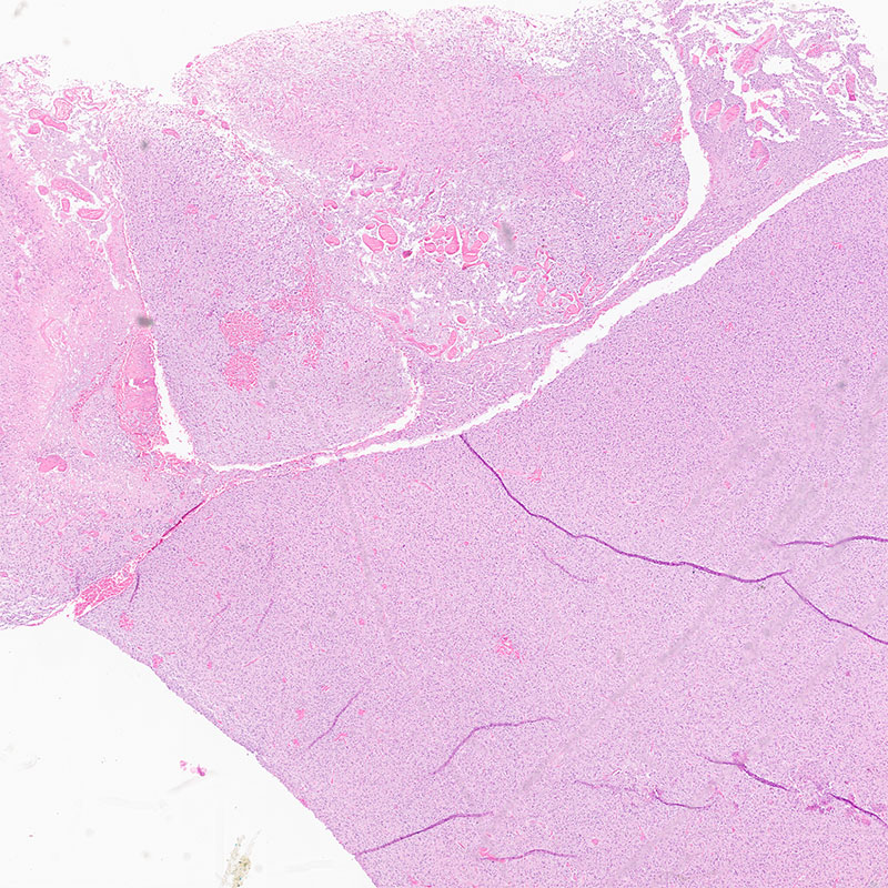 Perceptual / Saturation conversion of miscrscoptic tissue