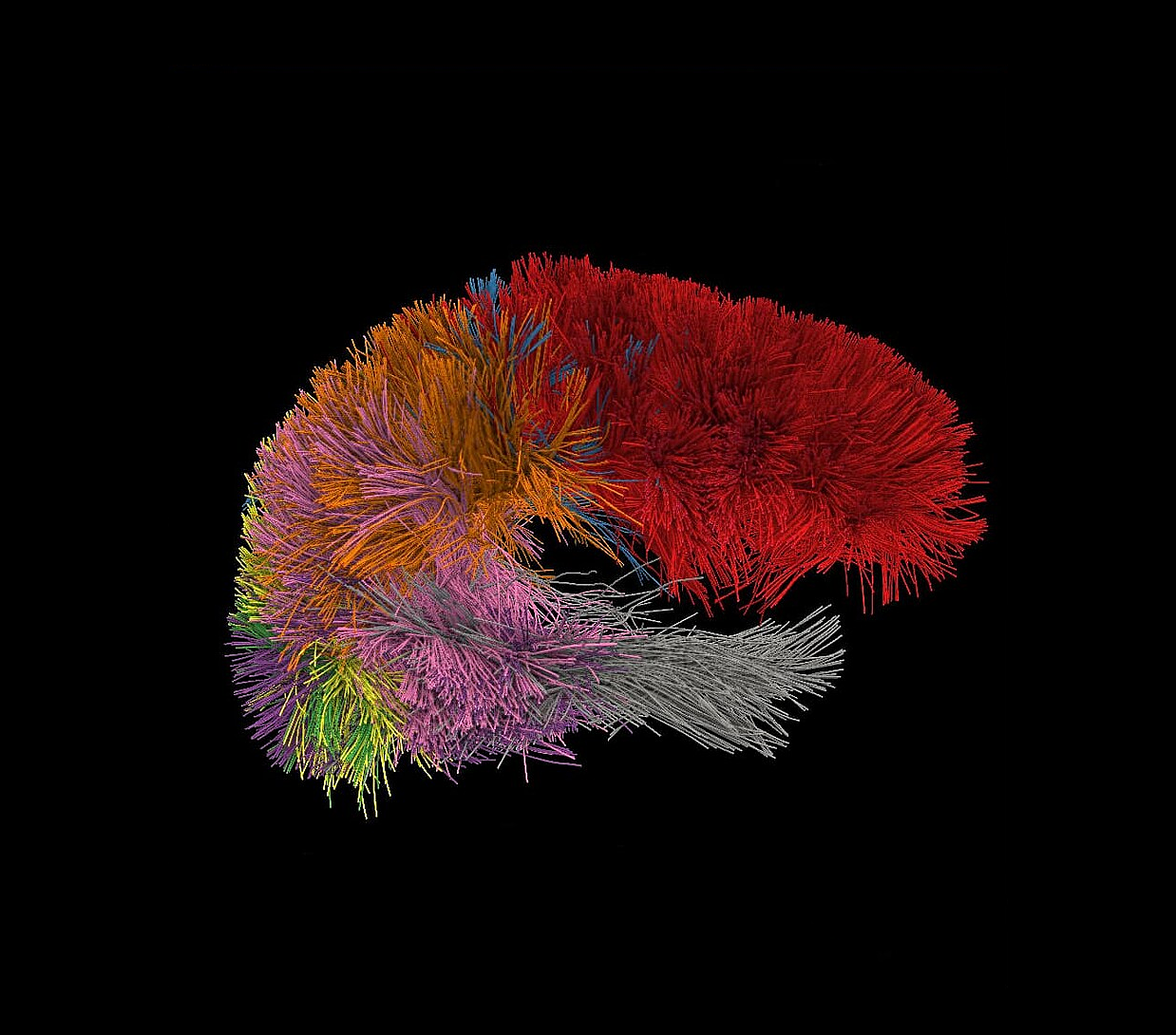 Slicer visualization of the human brain