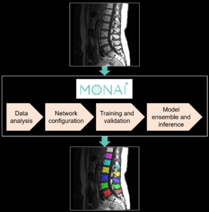 Developing custom 3D medical image segmentation solutions using out-of ...