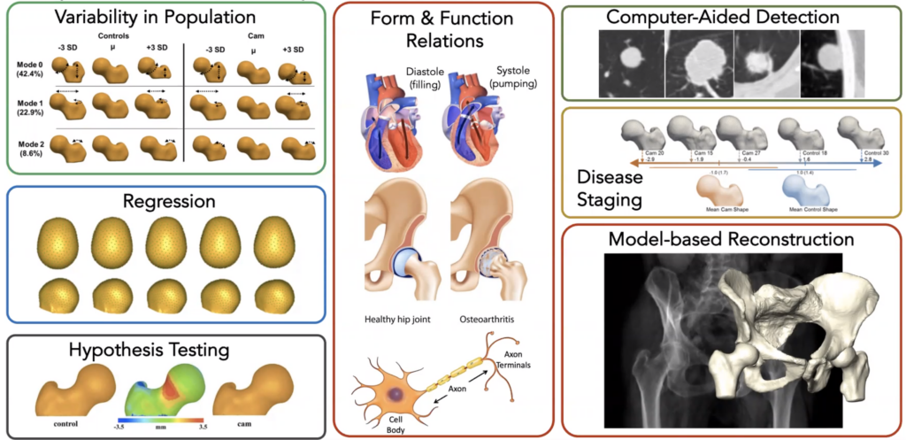 Important applications of statistical shape modeling. (image credit Shireen Elhabian, 2023, https://sciinstitute.github.io/ShapeWorks/. Used with permission.)
