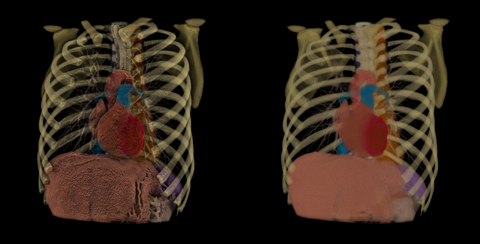 Screen-Space Ambient Occlusion for volumes
