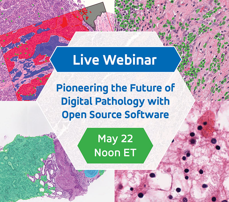 Live Webinar. Pioneering the Future of Digital Pathology with Open Source Software. May 22, 12PM ET.