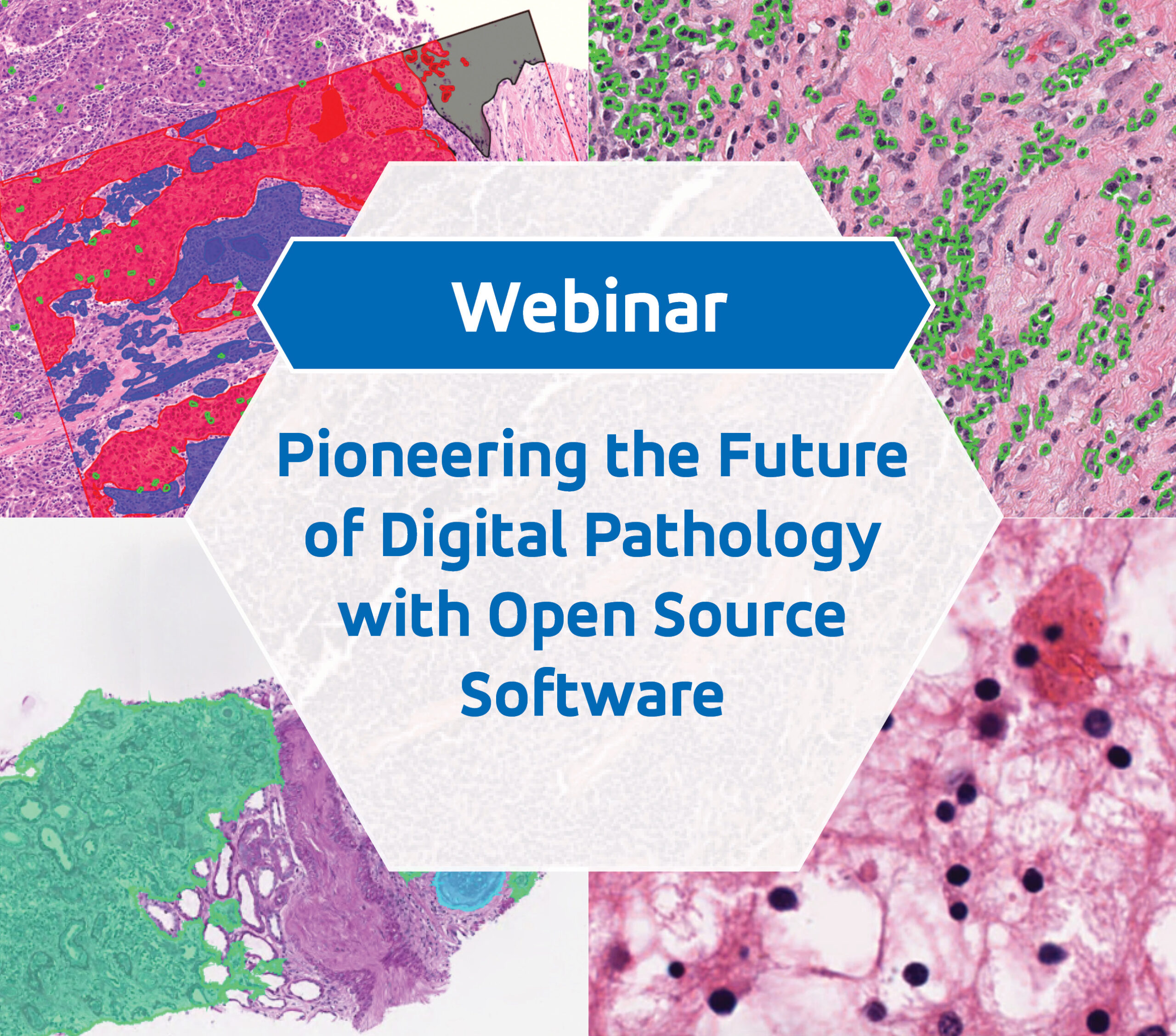 Webinar: Pioneering the Future of Digital Pathology with Open Source Software.
