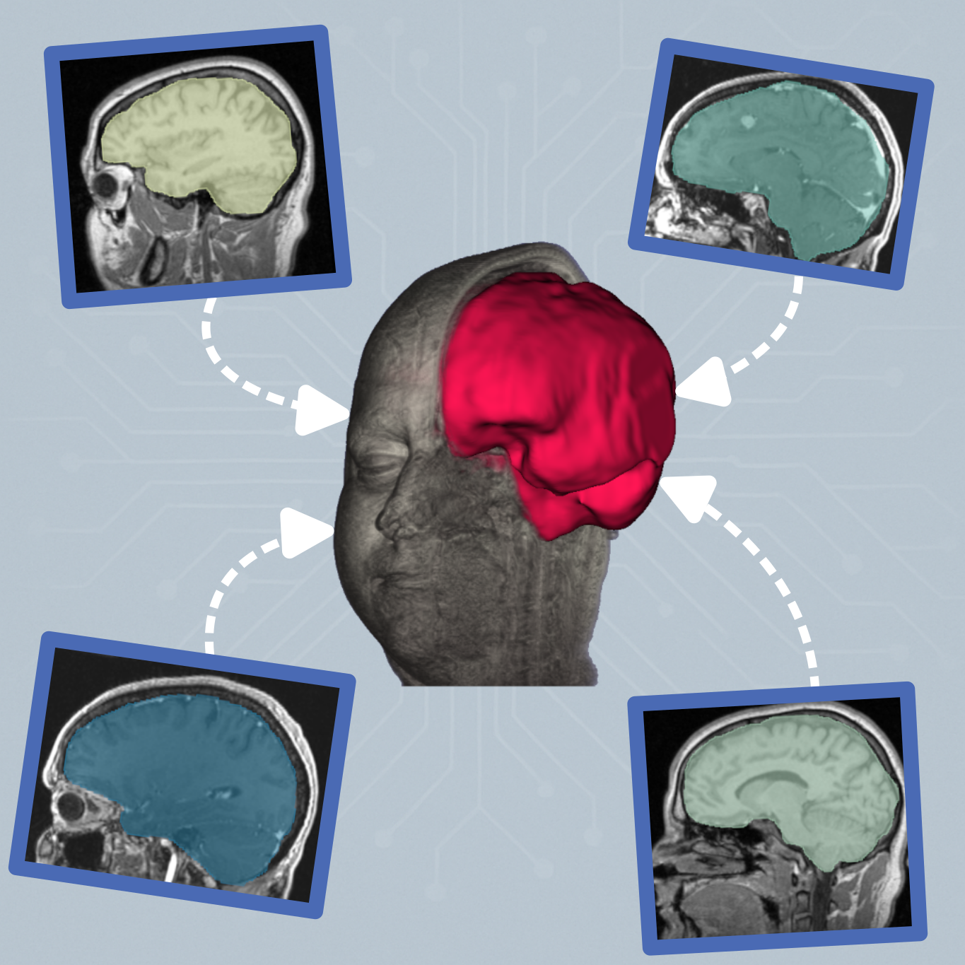 MultiverSeg learning context