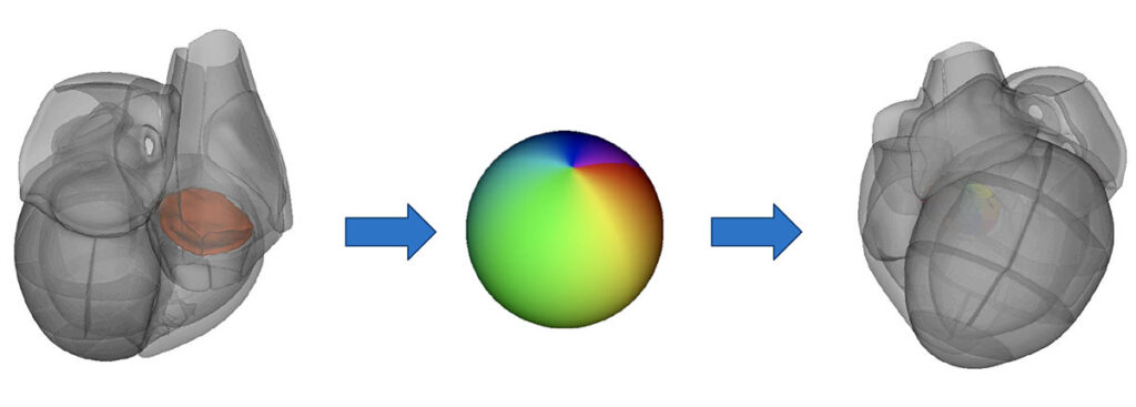 Tricuspid Valve Analysis