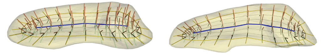 Neuroimaging Using Skeletal Models
