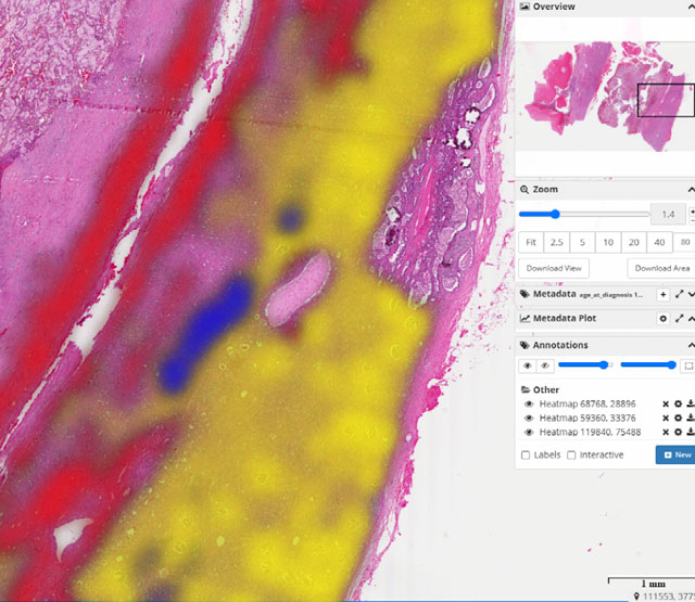Screenshot of HistomicsTK software