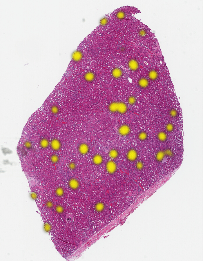 Glomeruli in renal tissue located using a foundation model