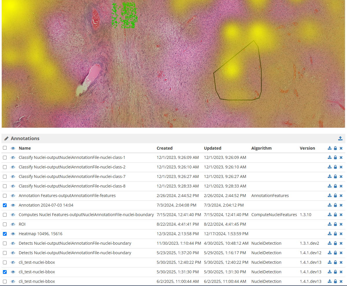 A list of annotations with extra metadata columns, several are showing on top of a whole slide image