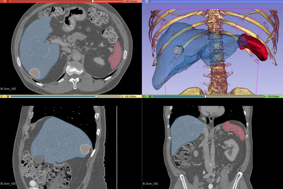 Multiple renderings of a body cavity showing bones and organ locations.