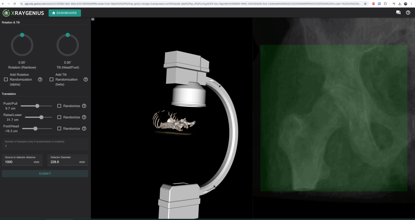 2D to 3D Reconstruction in Medical Imaging : Challenges and Solutions
