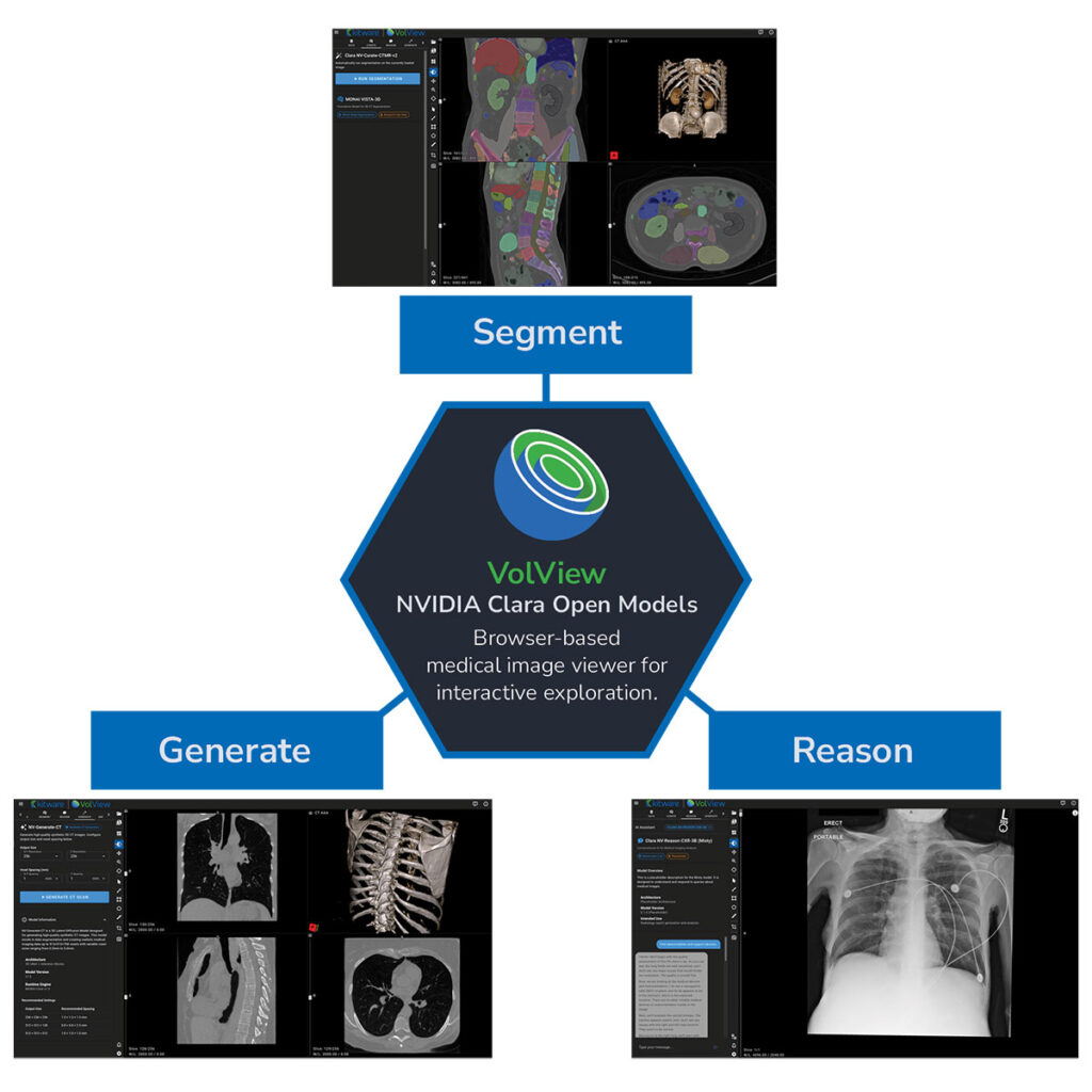 Volview / NVIDIA Clara Open Models. Browser-based medical image viewer for interactive exploration.