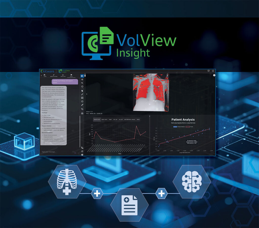 Screenshot of VolView Insight software showing patient analysis.
