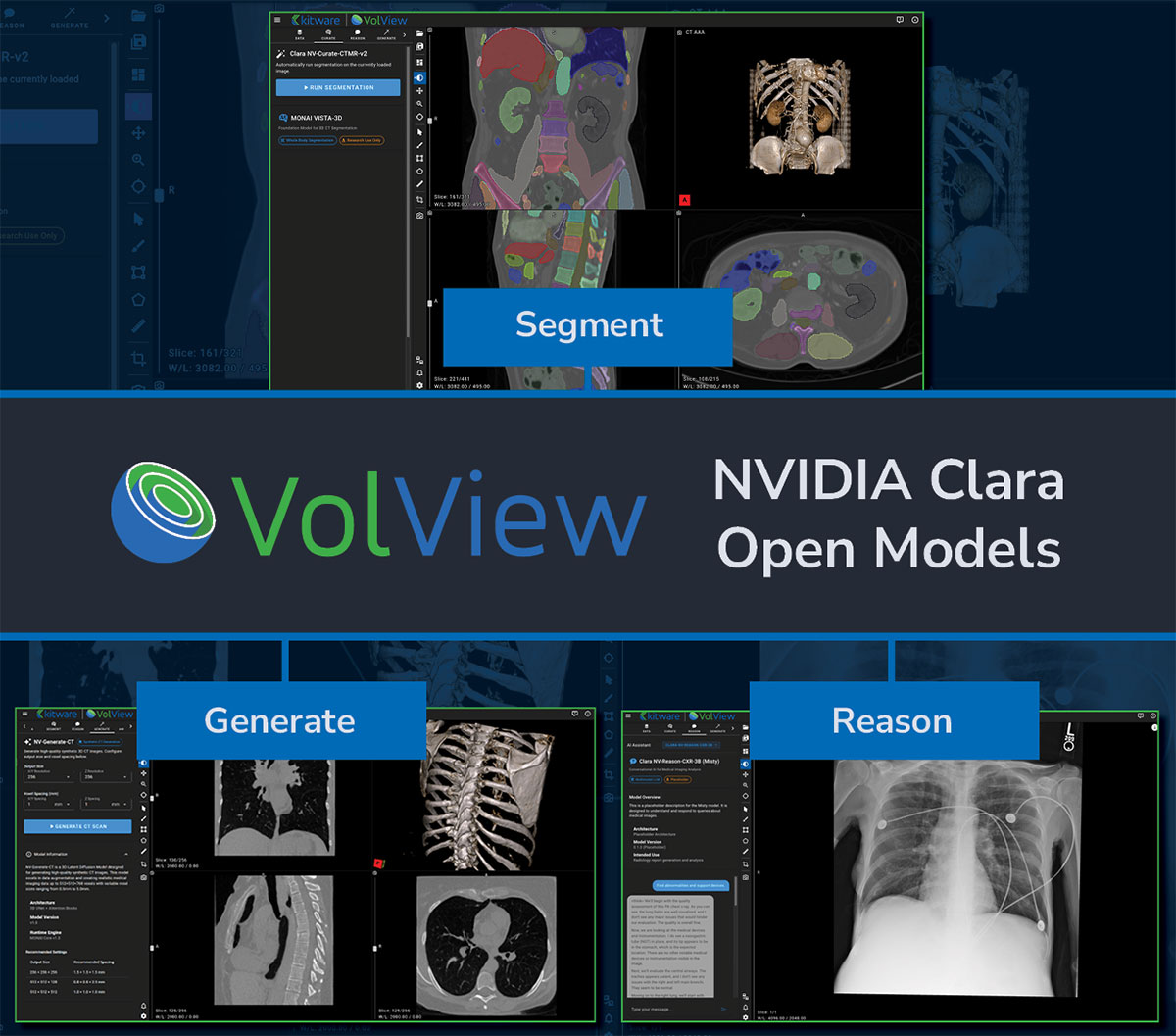 NVIDIA Clara Open Models | VolView