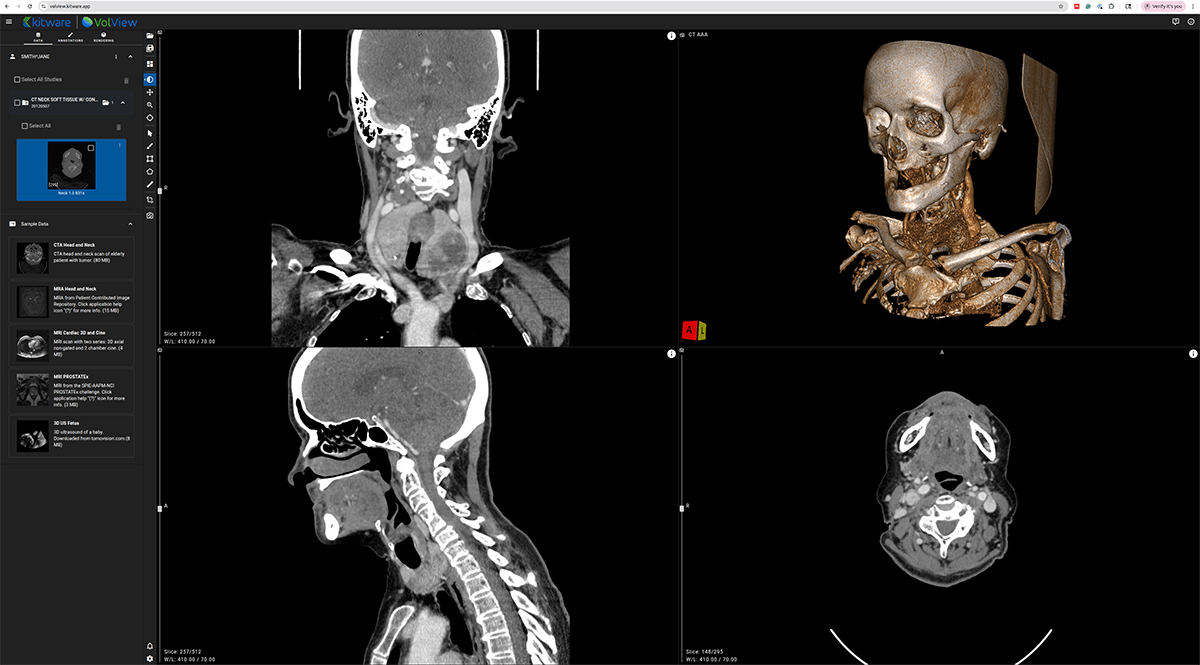VolView’s browser-native interface