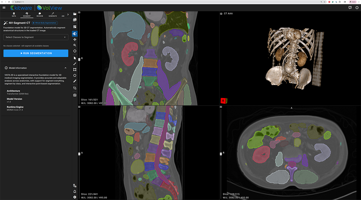 Example segmentation overlays produced using NV-Segment and displayed in VolView.