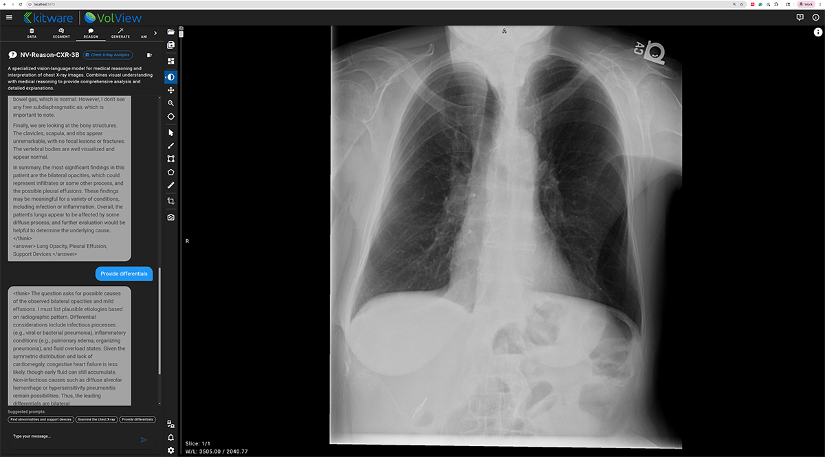 Multimodal reasoning output from NV-Reason presented through VolView’s chat interface.