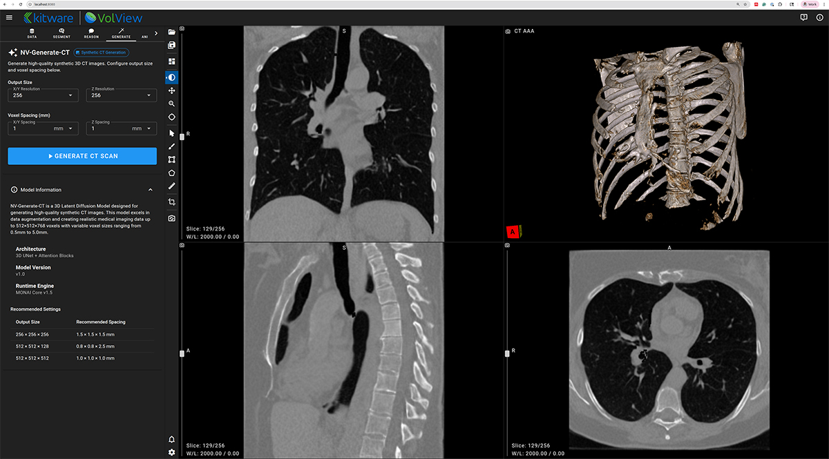Synthetic CT volume generated using NV-Generate was visualized inside VolView for exploration and analysis.