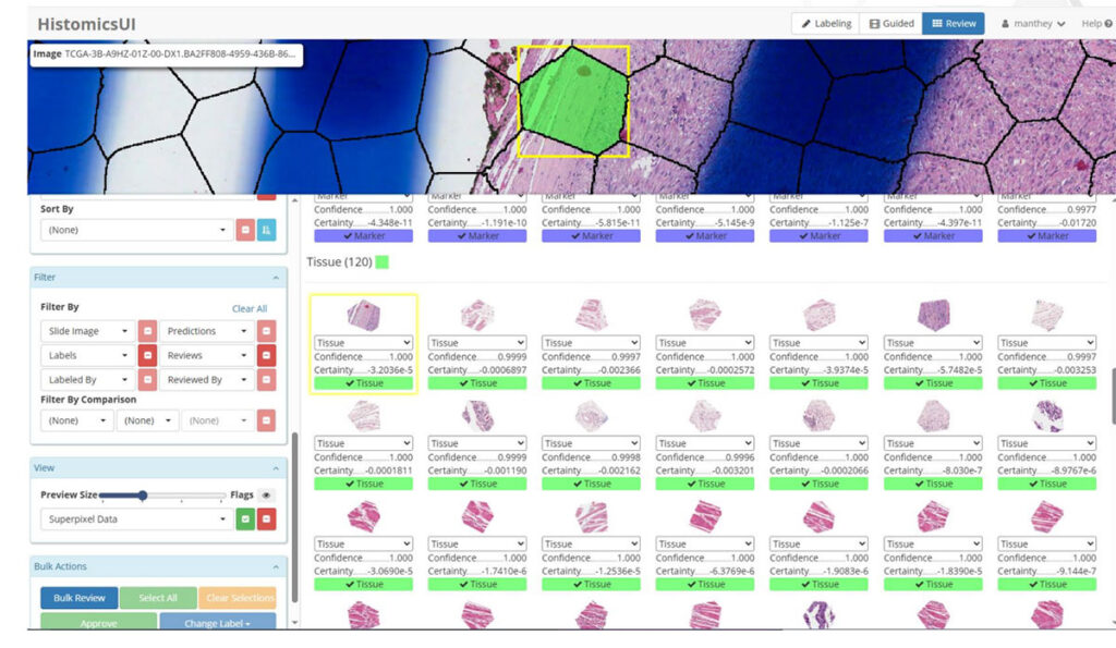 Screenshot of HistomicsUI showing pre-trained models and anonymize sensitive datasets.