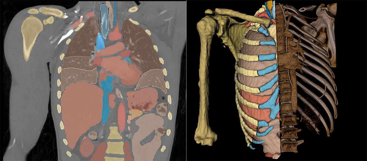 Visualization of a skeleton's chest with organs in it.