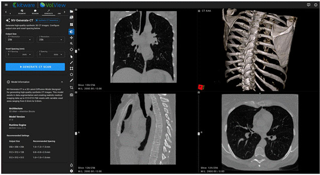 Synthetic CT volume generated using NV-Generate was visualized inside VolView for exploration and analysis.
