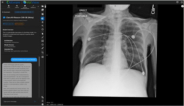 Multimodal reasoning output from NV-Reason presented through VolView’s chat interface.
