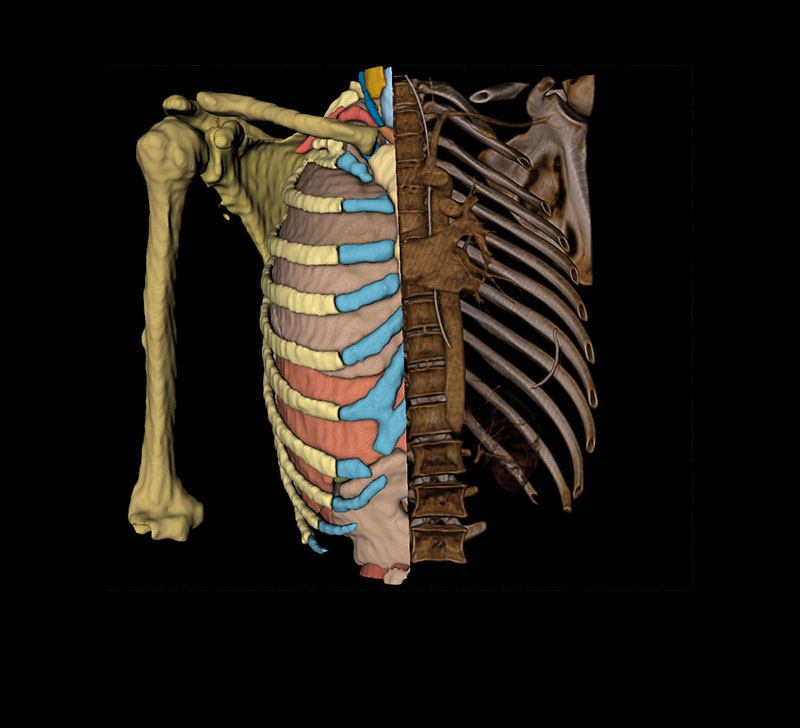 Visualization of a human chest showing ribs.