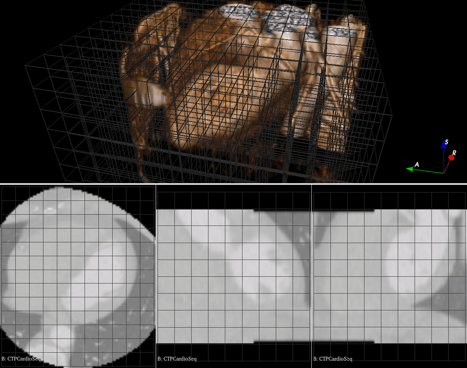 A sequence of grid transforms read by Slicer from a 5D NRRD file