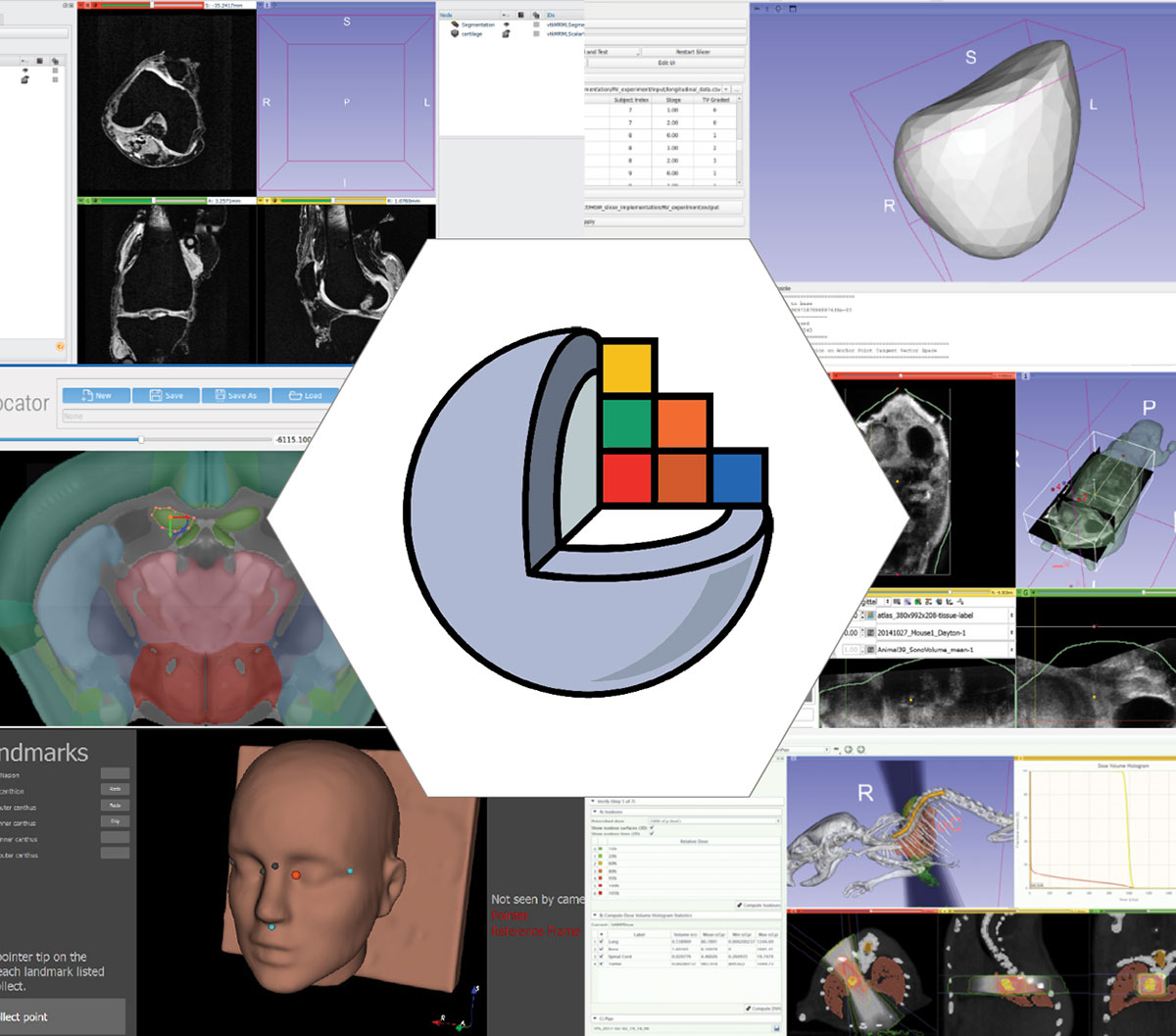 Creating Custom Applications based on 3D Slicer