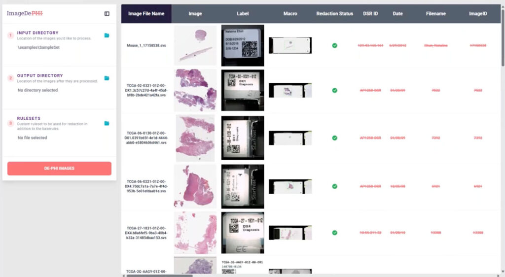 Screenshot of ImageDePHI