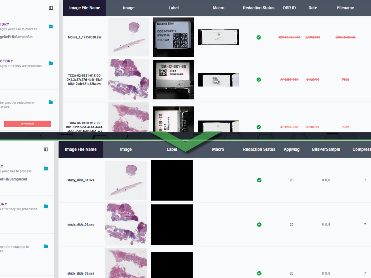 Screenshot of ImageDePHI and the removal of sensitive information.