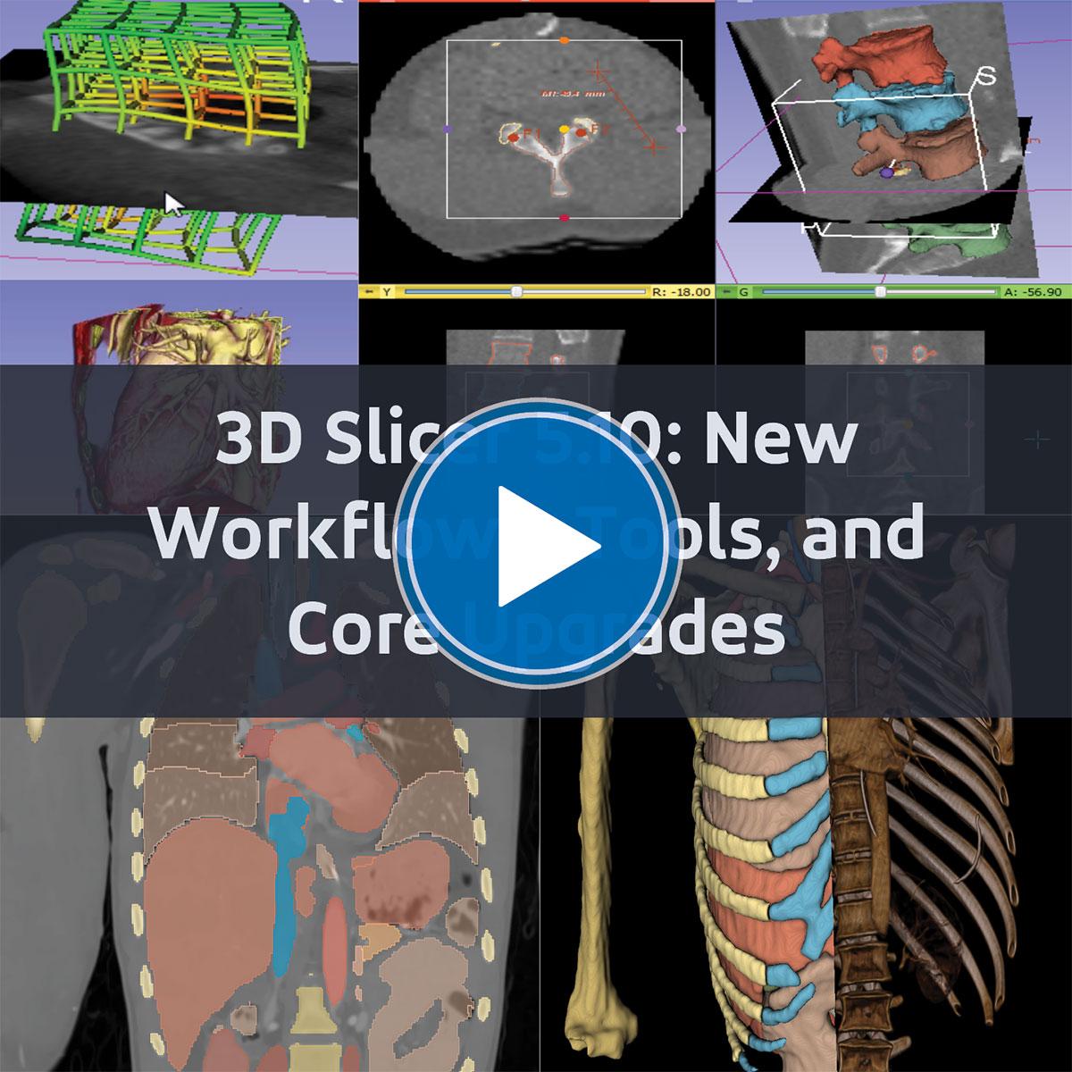 Unlock the Full Potential of Medical Imaging with 3D Slicer 5.10