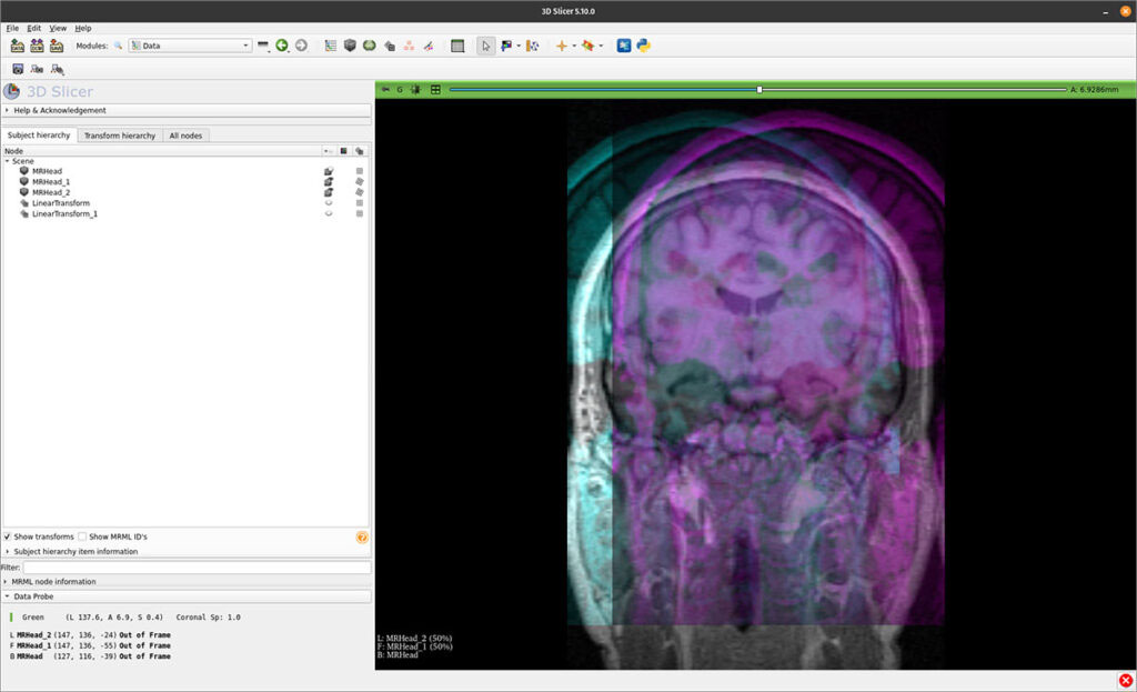 screenshot of 3d Slicer software
