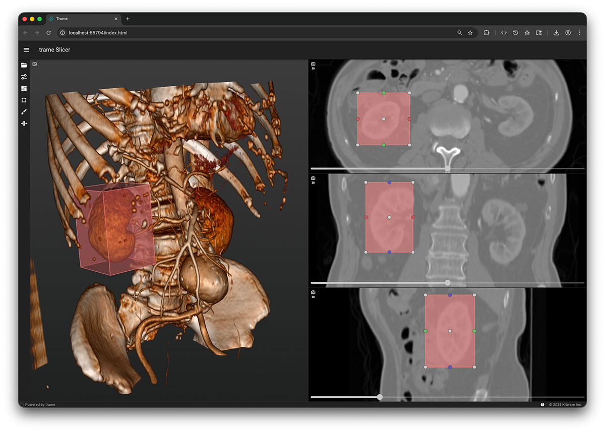 Building Reliable 3D Slicer Workflows