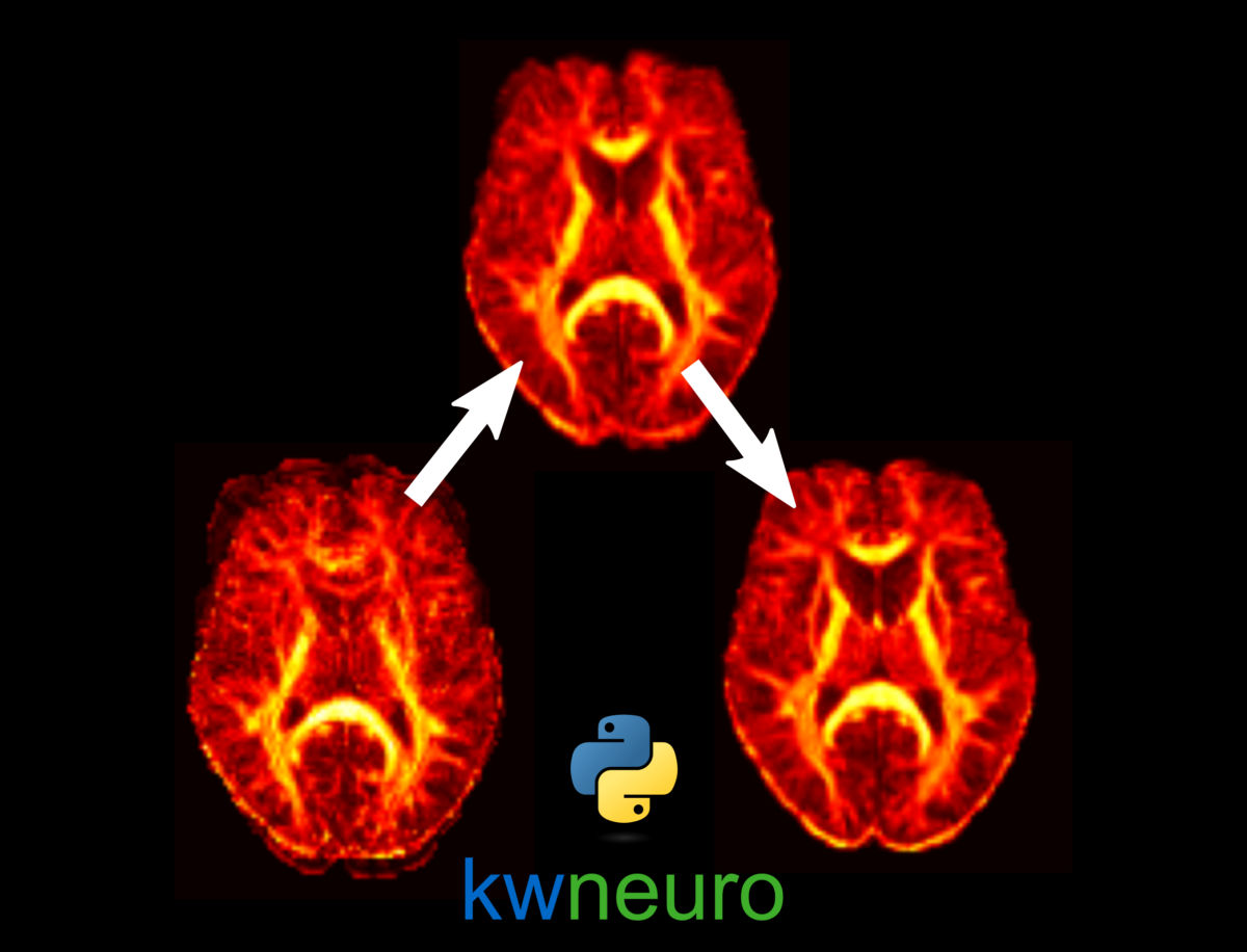 Designing an Open-source Python Framework for Large-Scale Diffusion MRI ...