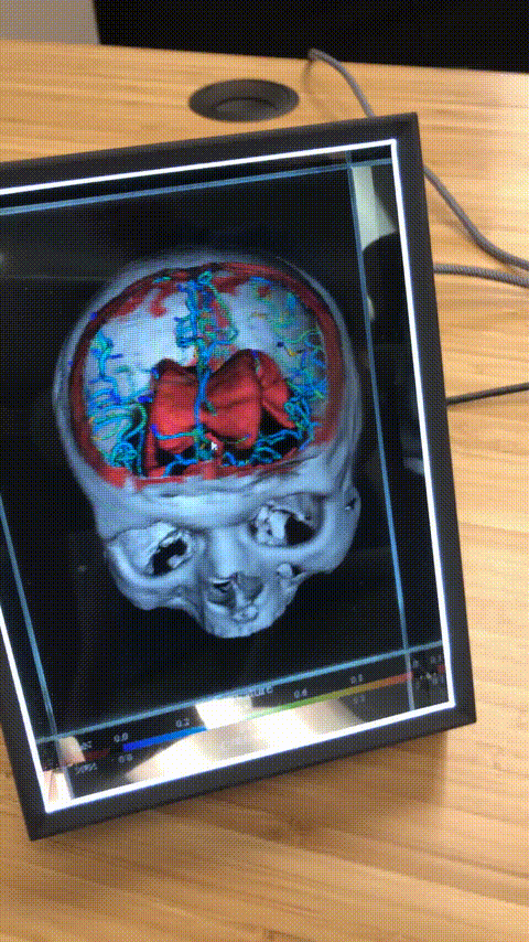 Holographic interface of human skull